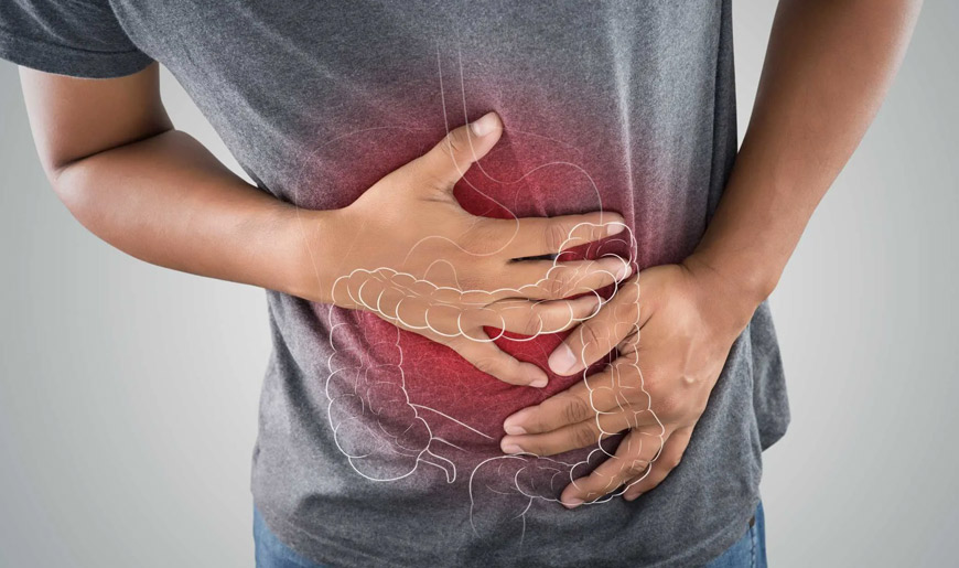Colon Cancer: Screening can prevent it