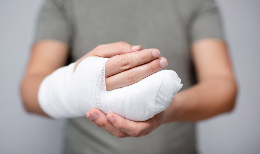 Hand Injuries at Work