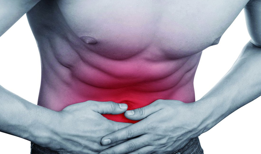 Hernia Repair