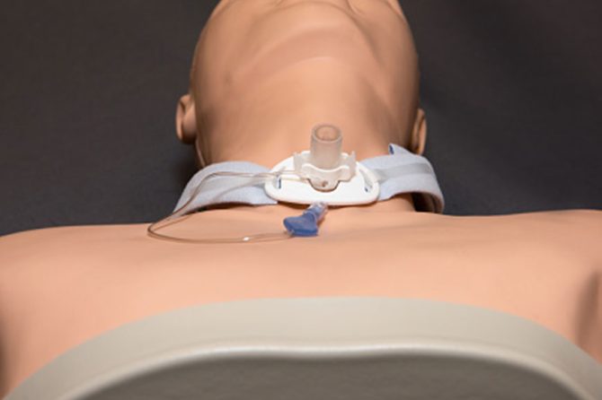 Here is about Tracheostomy