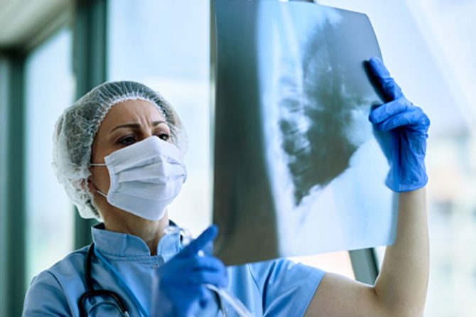 Here is About Pneumonia