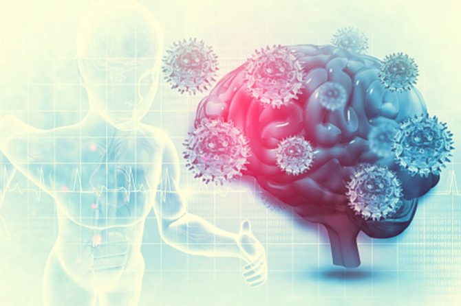 Here is about Encephalitis