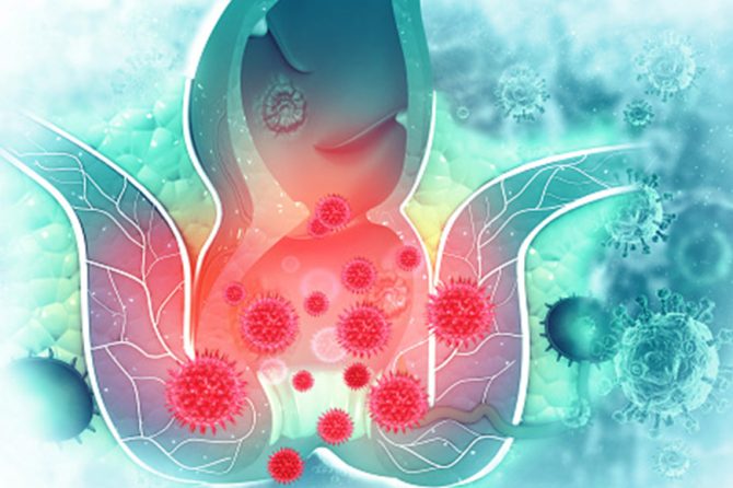 Here is About Hemorrhoids