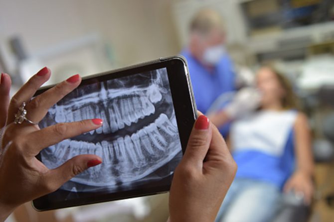 Here is About Dental X-ray