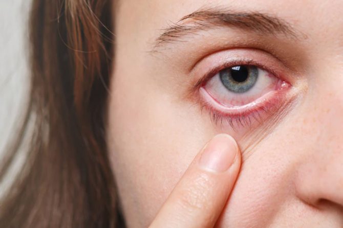 Common Eye-Related Warning Signs You Should Not Ignore