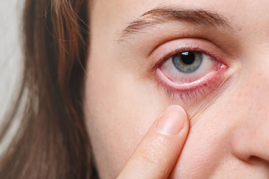 Common Eye-Related Warning Signs You Should Not Ignore